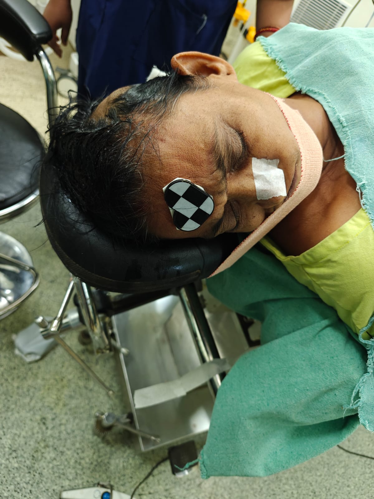 Neuro-Navigation Guided Stereotactic Brain Biopsy